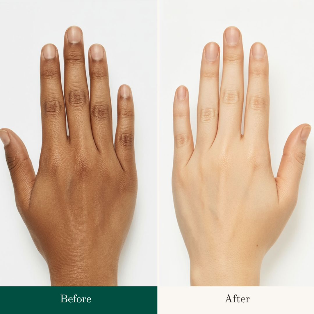Before After 14